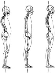 standing posture for back pain