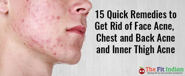 15 Ways to Get Rid of Acne, Chest, Back and Inner Thighs