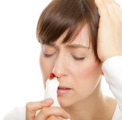 nose bleeds Symptoms