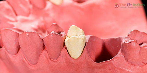 tooth-loss