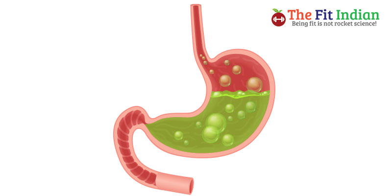 What do you know about Stomach Ulcers?