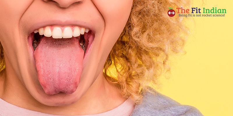 How does a healthy tongue look like?
