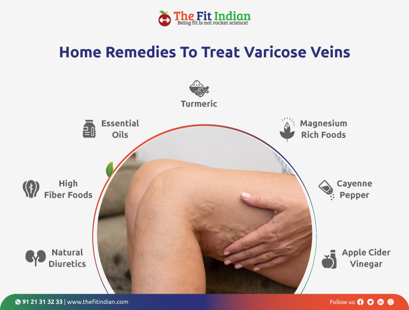 How to get rid of varicose veins with home remedies